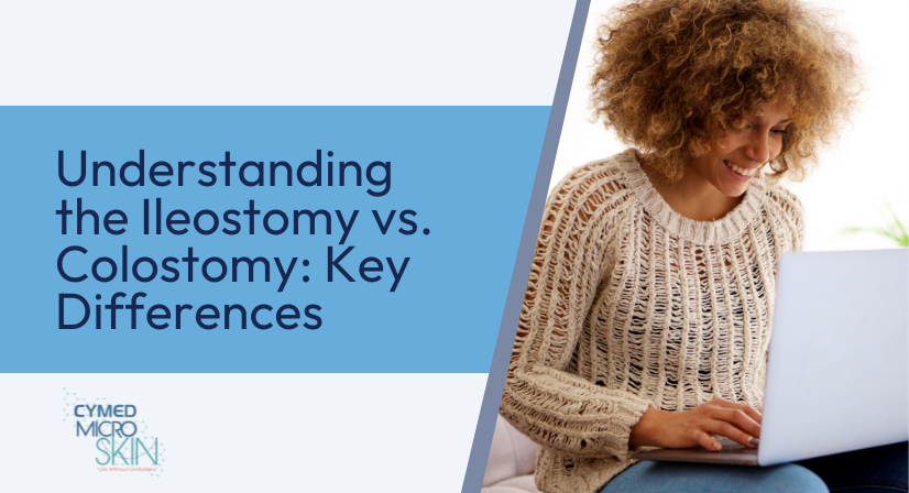 Understanding the Ileostomy vs. Colostomy Key Differences