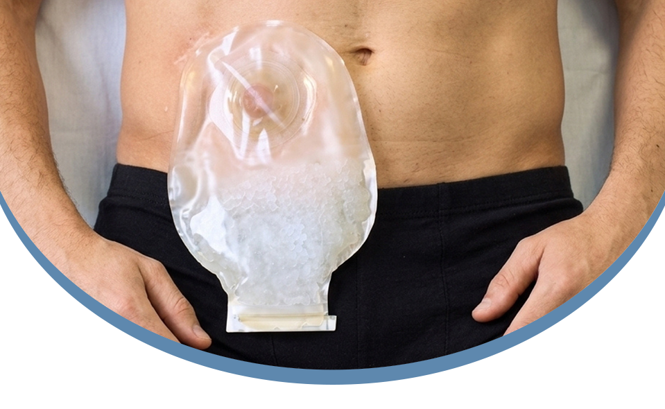 Ileostomy Supplies ILE-SORB Absorbent Gel Packets Banner